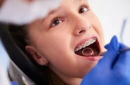 Orthodontic Treatment