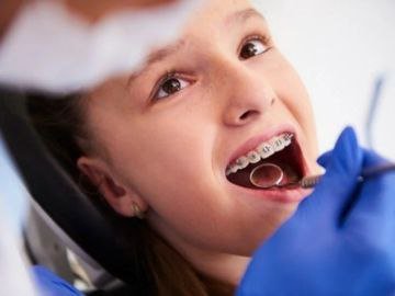 Orthodontic Treatment